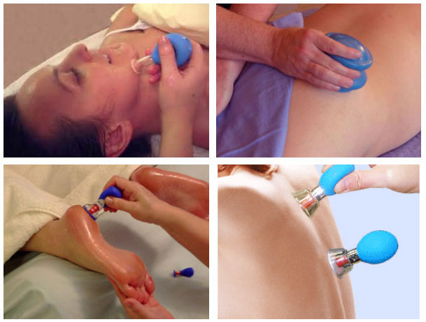 ziba's Spa Cupping Therapy