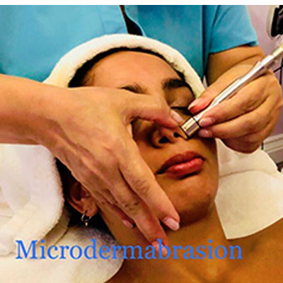 ziba's spa Microdermabrasion Facial